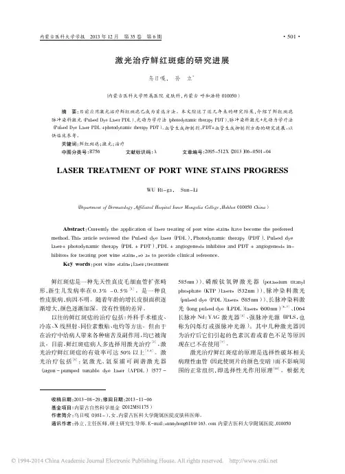 激光治疗鲜红斑痣的研究进展_乌日嘎孙立