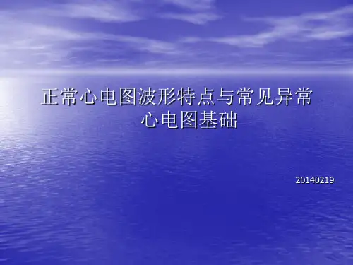 常见异常心电图知识