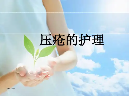 压疮护理.ppt