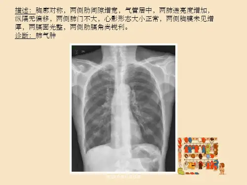 常见X片读片及诊断