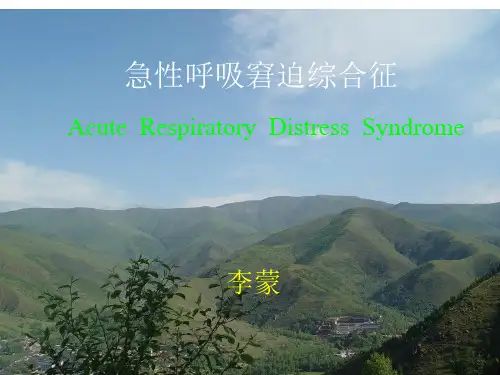 ARDS