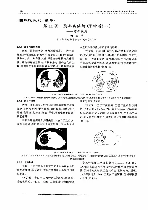 临床医生CT读片：第11讲  胸部疾病的CT诊断(二)——肺部疾病