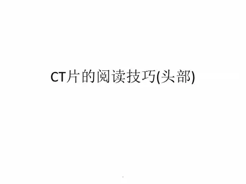 CT片的阅读技巧颅脑