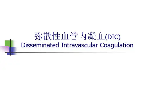 弥散性血管内凝血(DIC)
