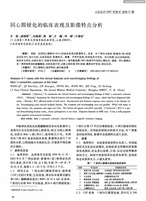 同心圆硬化的临床表现及影像特点分析