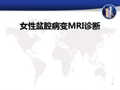 精编女性盆腔病变mri诊断 ppt课件