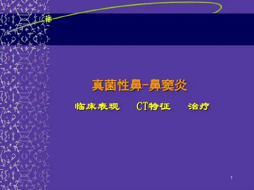 真菌性鼻鼻窦炎25页PPT