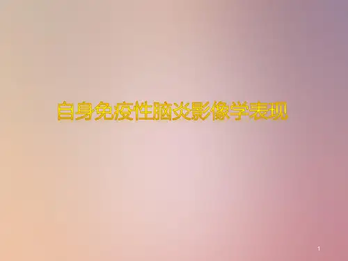自身免疫性脑炎PPT课件