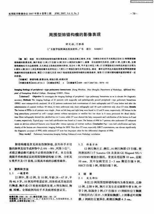 周围型肺错构瘤的影像表现