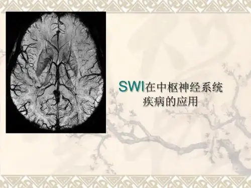 swi在中枢神经系统应用ppt课件-PPT精选文档