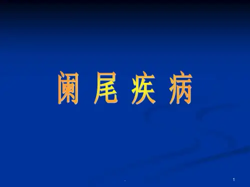 阑尾炎PPT课件PPT课件