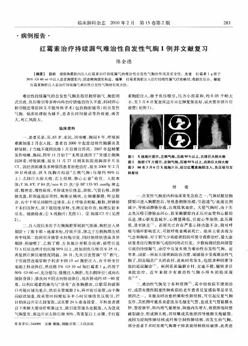 红霉素治疗持续漏气难治性自发性气胸1例并文献复习