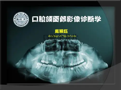 口腔全景片ppt课件
