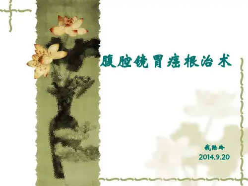 腹腔镜胃癌根治术