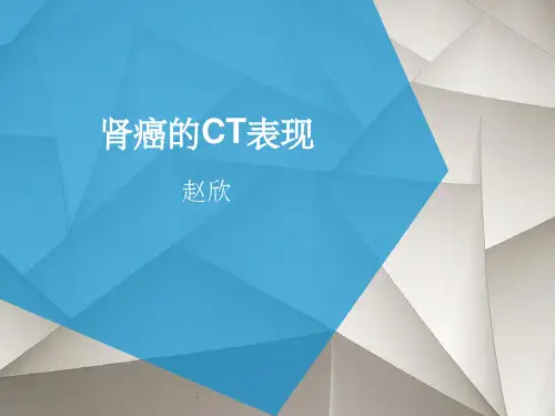 肾癌CT表现ppt课件