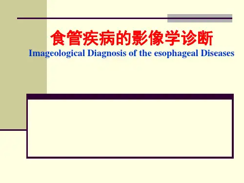 食管疾病影像学诊断