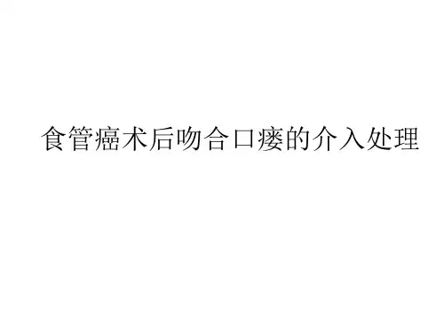 食管癌术后吻合口瘘的介入处理