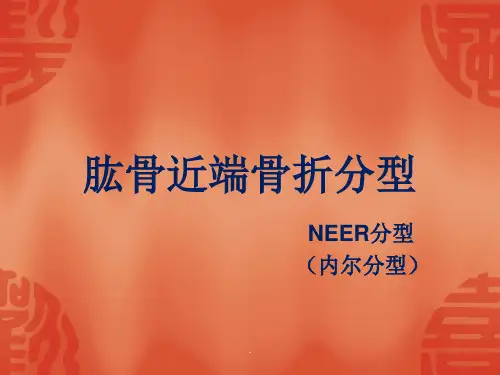 骨折常用分型