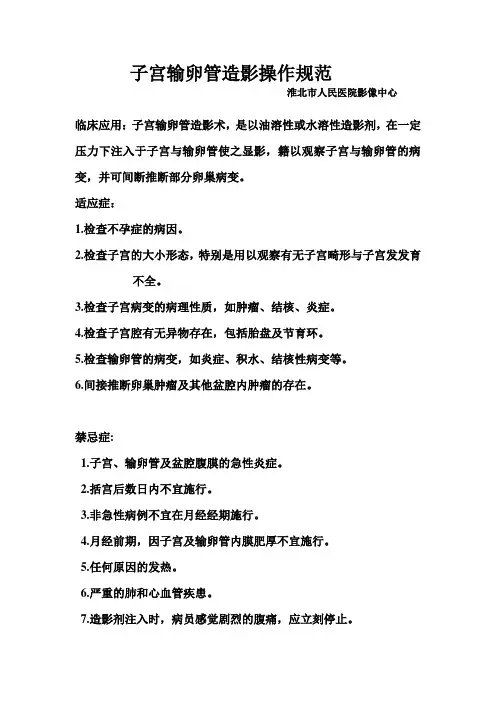 子宫输卵管造影操作规范