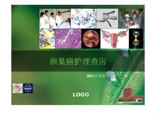 卵巢癌的护理查房(1)_图文.ppt