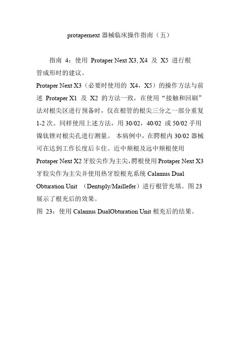 protapernext器械临床操作指南(五)