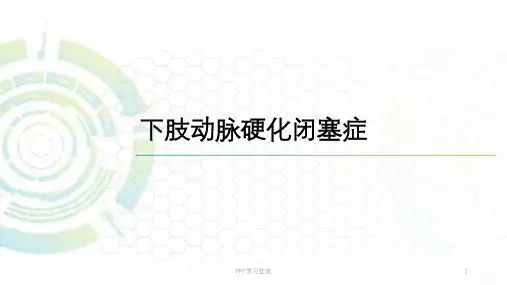 动脉硬化闭塞症课件