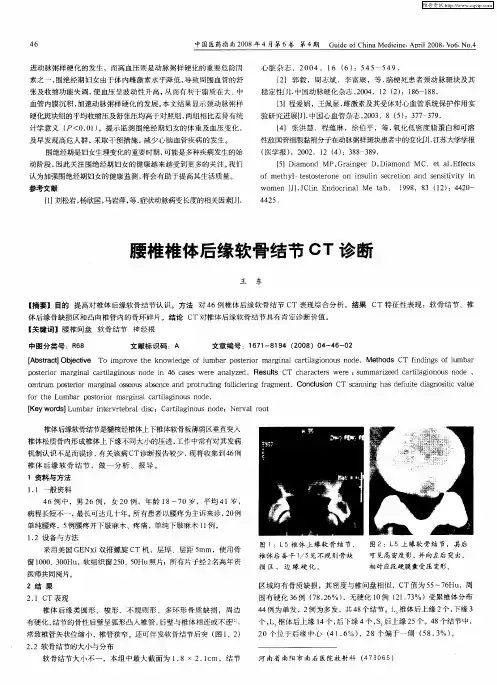 腰椎椎体后缘软骨结节CT诊断