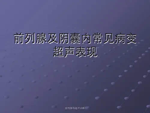 前列腺等超声诊断