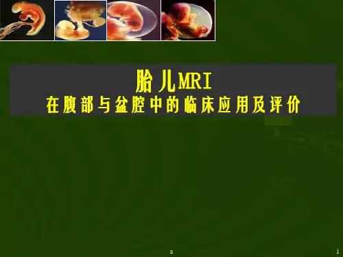 胎儿腹部MRI在腹部与盆腔中的临床应用及评价