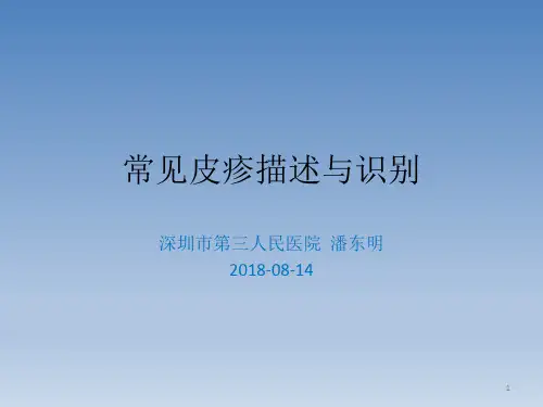 常见皮疹描述与识别PPT课件
