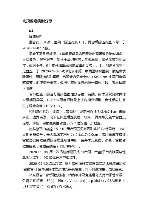 宫颈腺癌病例分享