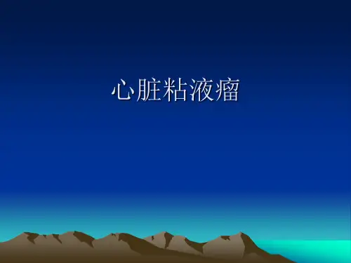 心脏粘液瘤