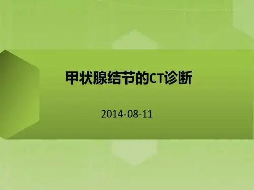名师推荐甲状腺结节的ct诊断