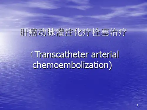 肝癌TACE治疗PPT精选课件