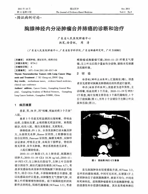 胸腺神经内分泌肿瘤合并肺癌的诊断和治疗