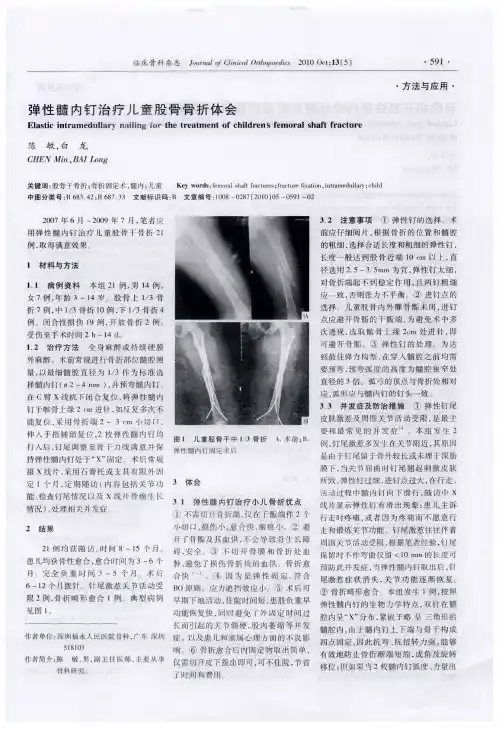 弹性髓内钉治疗儿童股骨骨折体会