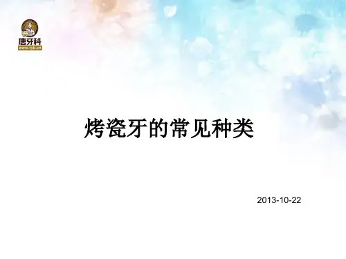 烤瓷牙的常见种类