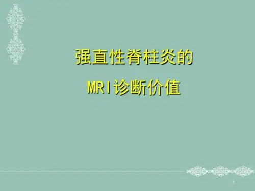 (优质课件)强直性脊柱炎的MRI诊断价值