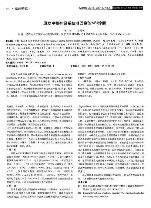 原发中枢神经系统淋巴瘤的MRI诊断