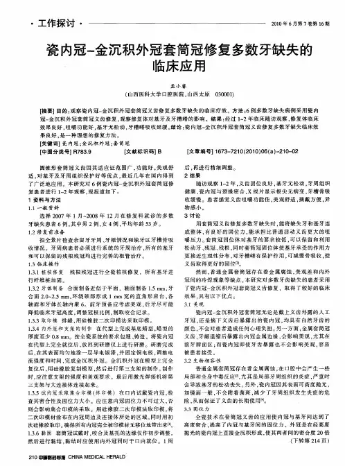 瓷内冠-金沉积外冠套筒冠修复多数牙缺失的临床应用