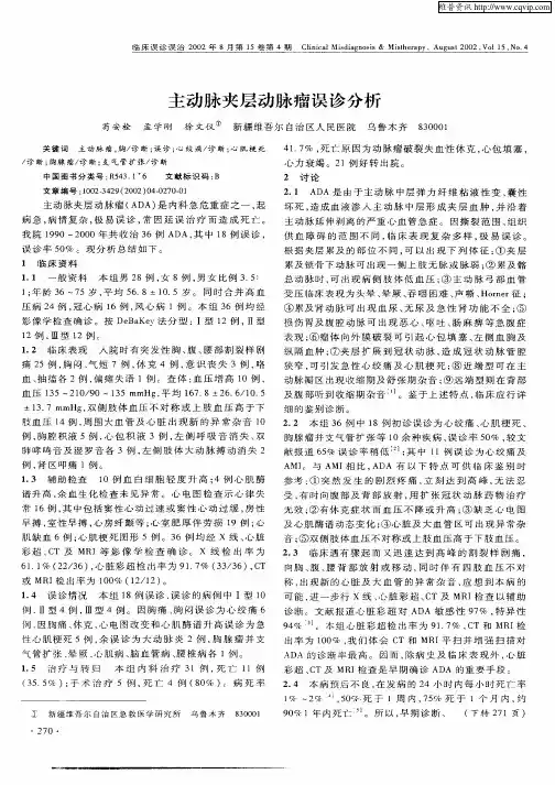 主动脉夹层动脉瘤误诊分析