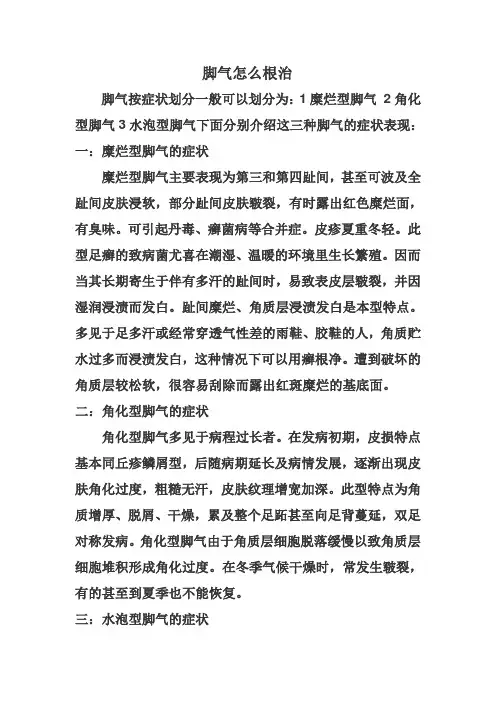 脚气怎么根治
