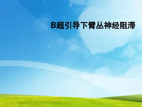 超声引导下臂丛神经阻滞PPT课件