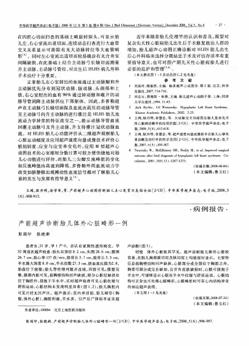 产前超声诊断胎儿体外心脏畸形一例