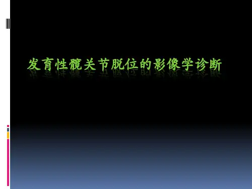 发育性髋关节脱位影像学诊断