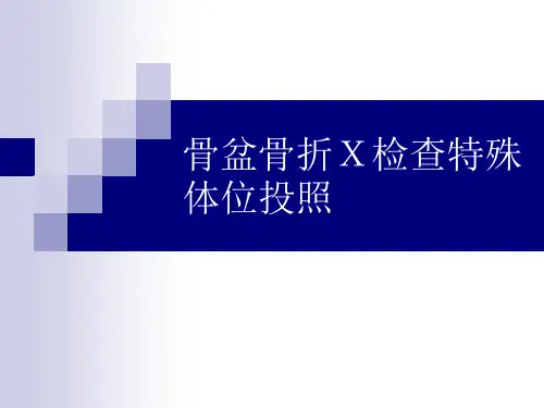 骨盆X线投照技术
