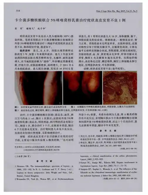 卡介菌多糖核酸联合5%咪喹莫特乳膏治疗疣状表皮发育不良1例