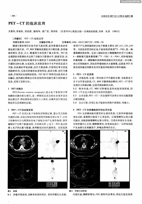 PET-CT的临床应用