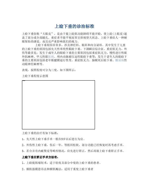 上睑下垂的诊治标准