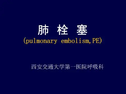 医学课件-肺栓塞-交通大学第一医院呼吸科_PPT课件